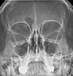 radiologia_cranio