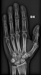 radiologia_mano